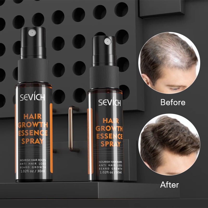 Portable Hair Growth Essence Spray Professional Nourish Hair Roots Anti Hair  Loss Beard Growth Products New 