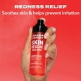 thumbnail image 4 of Hard Candy Skin Rescue Spray, Hypochlorous Acid, Redness Relief, Skin Calming Face Mist, 100 mL, 4 of 7