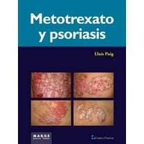 Metotrexato y psoriaris (Paperback)