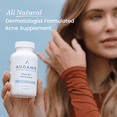 thumbnail image 2 of Augamis Clear Skin Supplement DIM-Free,Acne Supplement for Hormonal Acne Treatment 60 Capsules, 2 of 7