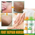 thumbnail image 1 of Fiudx Ofertas Flash Del Día El Spray Exfoliante Para Pies Exfolia Suavemente La Piel Muerta, Limpia, Desodoriza, Elimina Los Callos, Mantiene La Piel Del Pie Suave Y, 1 of 7