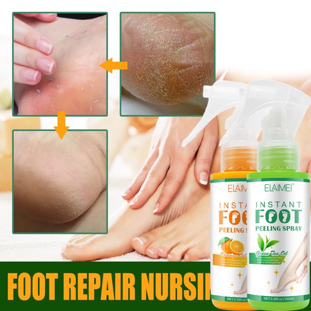 Fiudx Ofertas Flash Del Día El Spray Exfoliante Para Pies Exfolia Suavemente La Piel Muerta, Limpia, Desodoriza, Elimina Los Callos, Mantiene La Piel Del Pie Suave Y