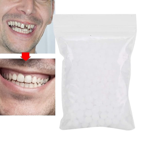 Dentures Temporary Teeth Instant Veneers Dentures Thermal Adhesive Beads Temporary Tooth Repair For Attaching Missing (100 G)