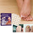 thumbnail image 4 of Pegatinas para tratamiento de uñas encarnadas Parche de corrección de uñas de los pies Herramienta de cuidado de uñas unisex, 4 of 9