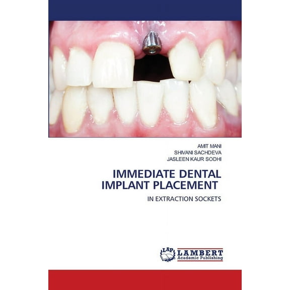 Immediate Dental Implant Placement (Paperback)
