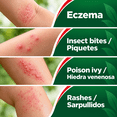 thumbnail image 2 of Barmicil Maximum Strength 1% Hydrocortisone Anti-Itch Cream with Aloe Vera, 1 oz, 2 of 8