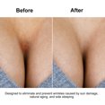 thumbnail image 4 of Reusable Silicone Chest Pad Eliminate and Chest Wrinkles, 4 of 6