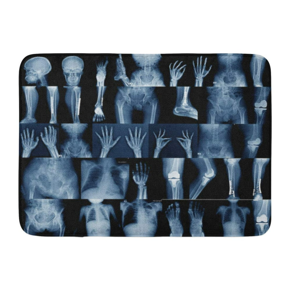 KDAGR Accident Very Good X Ray Collection in Blue Tone Anatomy Arm