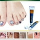 thumbnail image 5 of Crema para eliminar hongos en los pies Sincero 15g, 5 of 10
