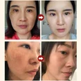 thumbnail image 5 of Suero Facial de niacinamida, ácido salicílico, productos hidratantes para el cuidado de la piel, 2024, 5 of 5