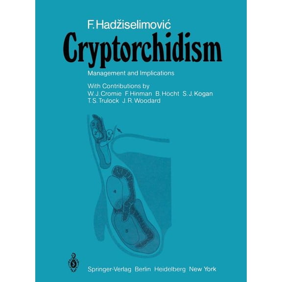 Cryptorchidism: Management and Implications, (Paperback)