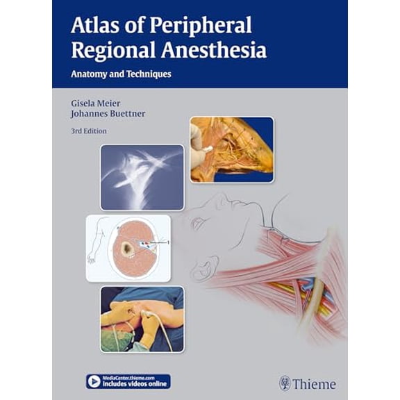Pre-Owned Atlas of Peripheral Regional Anesthesia: Anatomy and Techniques, 9783131397935, 3131397934, Hardcover, 3rd edition edition