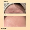 thumbnail image 3 of Sérum hidratante COSRX Snail Mucin 96% Power Repair 100 ml, 3 of 8