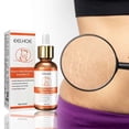 thumbnail image 2 of Skin repair essential oil pregnant women's skin stretch mark skin care essence, 2 of 5