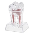 thumbnail image 1 of Qarigey Modelo molar de de plástico duro con base de cristal para la enseñanza del estudio cuidado de los oídos, 1 of 1
