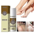 thumbnail image 1 of Anti Fungal Infections Fungus Combat Feet Spray Athlete's Foot Spray, 1 of 5