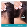 thumbnail image 2 of Shampoo Anti-Caída Caviar Professional 500ml, 2 of 4