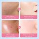 thumbnail image 4 of Limpiador facial revitalizante que elimina las pecas, ilumina el tono de la piel, reduce los poros y disminuye la exfoliación. 100 g., 4 of 6