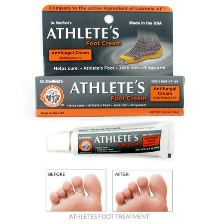 Athlete's Foot Antifungal Cream Treatment Jock Itch Ringworm Itching Anti