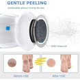 thumbnail image 4 of SHAR Dual Speed ​​Callus Remover Electric, Foot Heel Repair Electric Foot File Pedicure Foot Care Tool Dead, 4 of 5
