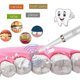 thumbnail image 3 of Ultrasonic Scaler Tips Handpiece Fit for Electric Toothbrush Remove Dental Calculus Plaque Tooth St, 3 of 5