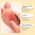 thumbnail image 4 of Bee Venom Foot Soothing Spray Quick Relieve Foot Discomforts, Anti-Fungal Treatment Foot Care, 4 of 5