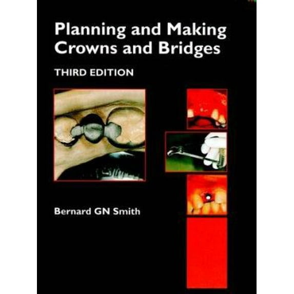 Pre-Owned Planning and Making Crowns and Bridges (Hardcover) 1853173142 9781853173141