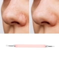thumbnail image 5 of Unique Bargains 1 Pc Facial Pimple Extractor Pink 7.08", 5 of 7
