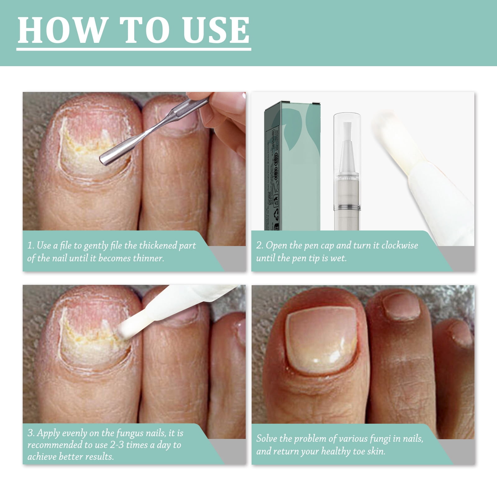 Alvantor Nail Care Pen with Aloe & Tea Tree Oil, Fungal Nail & Moisturizing Cuticle Treatment