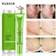 thumbnail image 2 of Buy 2 Save 10% Acne Extract Acne Removal Marks Facial, 2 of 9
