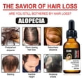 thumbnail image 2 of Aceite esencial para el crecimiento del cabello HUOGUO Plant Anticaída, 30 ml, 2 of 4