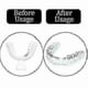 thumbnail image 3 of 12 Pack Silicone Dental Night Guard for Teeth Clenching & Grinding, Anti Bruxism Sleep Aid (Mouth Guard), 3 of 5