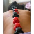 thumbnail image 3 of RockTape RockPods 2-Piece Cupping Set with Carrying Case, 3 of 6