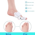 thumbnail image 5 of Corrector de juanetes para mujeres (2 piezas) Almohadillas para férulas para hallux valgus Separadores de juanetes para dedos gordos Alisador, 5 of 5