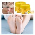 BKBP Banana Repair Cream Foot Care and Cracking 2pc Moisturize Feet