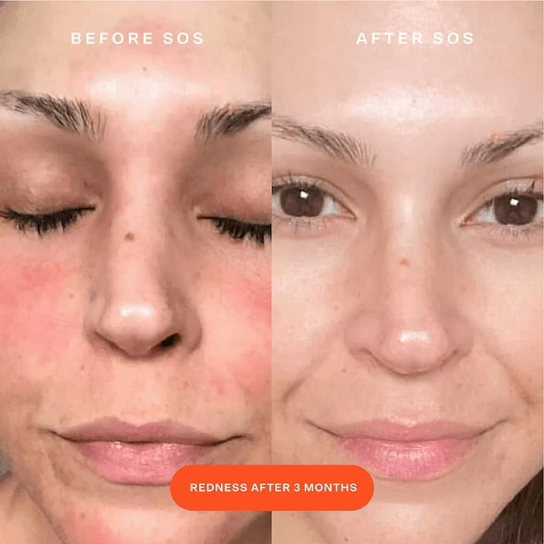 Tower 28 Beauty SOS Daily Rescue Facial Spray with Hypochlorous Acid 1 oz/ 30 mL