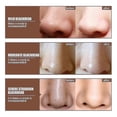 thumbnail image 4 of Jaysuing Of Blackhead Removal Nose Mask Deeply Cleans Blackheads And Pimples |, 4 of 4