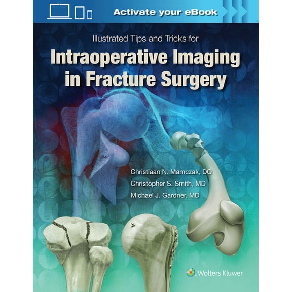 Illustrated Tips and Tricks for Intraoperative Imaging in Fracture Surgery, (Hardcover)