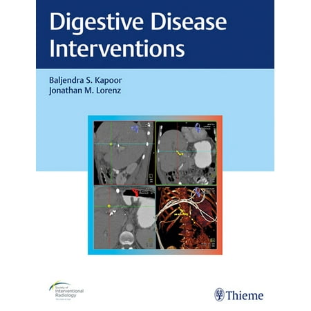 UPC: 9781626233744 | Digestive Disease Interventions (Hardcover)