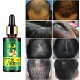 thumbnail image 4 of 3pcs Hair Growth Serum Natural Essential Oil Hair Regrowth Treatment Repair Care Oil, 4 of 5