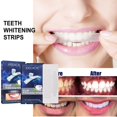 thumbnail image 2 of Whitening teeth strips care teeth strips stains white teeth whitening clean tartar tooth stains smoke teeth brighten 1, 2 of 3