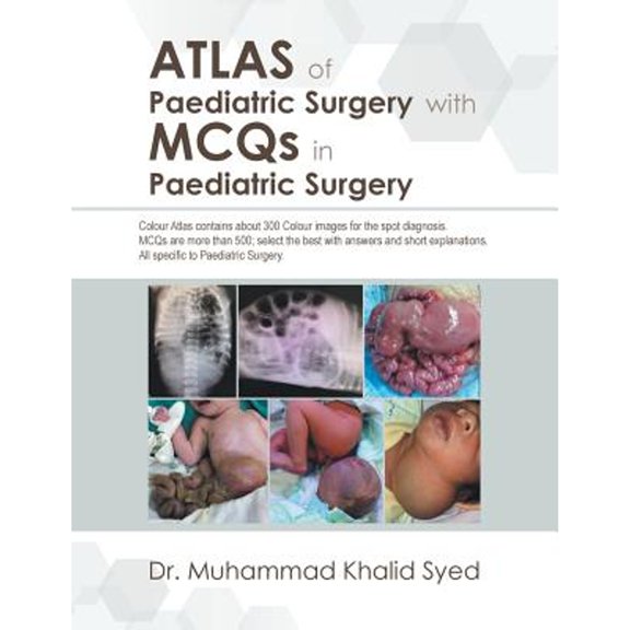 Atlas of Paediatric Surgery with Mcqs in Paediatric Surgery (Paperback)
