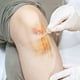 thumbnail image 5 of 2 hisopos puntiagudos de precisión, hisopos de algodón de doble punta, hisopos para tatuajes, limpieza y belleza (100 unidades/bolsa), 5 of 7