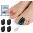 thumbnail image 1 of wonima11 Hammer Toe Corrector For Women & Men - 4 Pcs Hammer Toe Straightener With Aluminum Plate, Toe Splints & Wraps Support For Crooked, Curled, Bent Toes - Black, 1 of 1