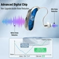 thumbnail image 2 of iadr Hearing Aids for Seniors with Noise Cancelling and Volume Control, Rechargeable Hearing Aids for Hearing Loss with Charging Case,Pair,Silver, 2 of 10