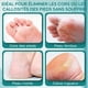 thumbnail image 5 of Raspador eléctrico para pies (16,5 x 6,5 x 3,5 cm), con 3 rodillos y 2 velocidades, recargable, para pedicura y eliminación de callos., 5 of 5