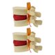 thumbnail image 1 of 2X Lumbar Vertebrae Model Anatomical Spine Lumbar Disc Herniation Anatomy Teaching Tool Lumbar Vertebrae Model, 1 of 5
