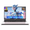 Rose Gold, variant on 15.6" IPS FHD Gaming Laptop 32GB DDR5 RAM 1TB SSD AMD Ryzen 7 8745HS (8 Cores Up to 4.9GHz) Radeon 780M Graphics with 100W USB-C Backlit Keyboard Fingerprint USB4.0 Blue