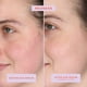 thumbnail image 3 of Serum Tower 28 SOS Intensive Rescue para pieles sensibles, 60 ml, 3 of 9