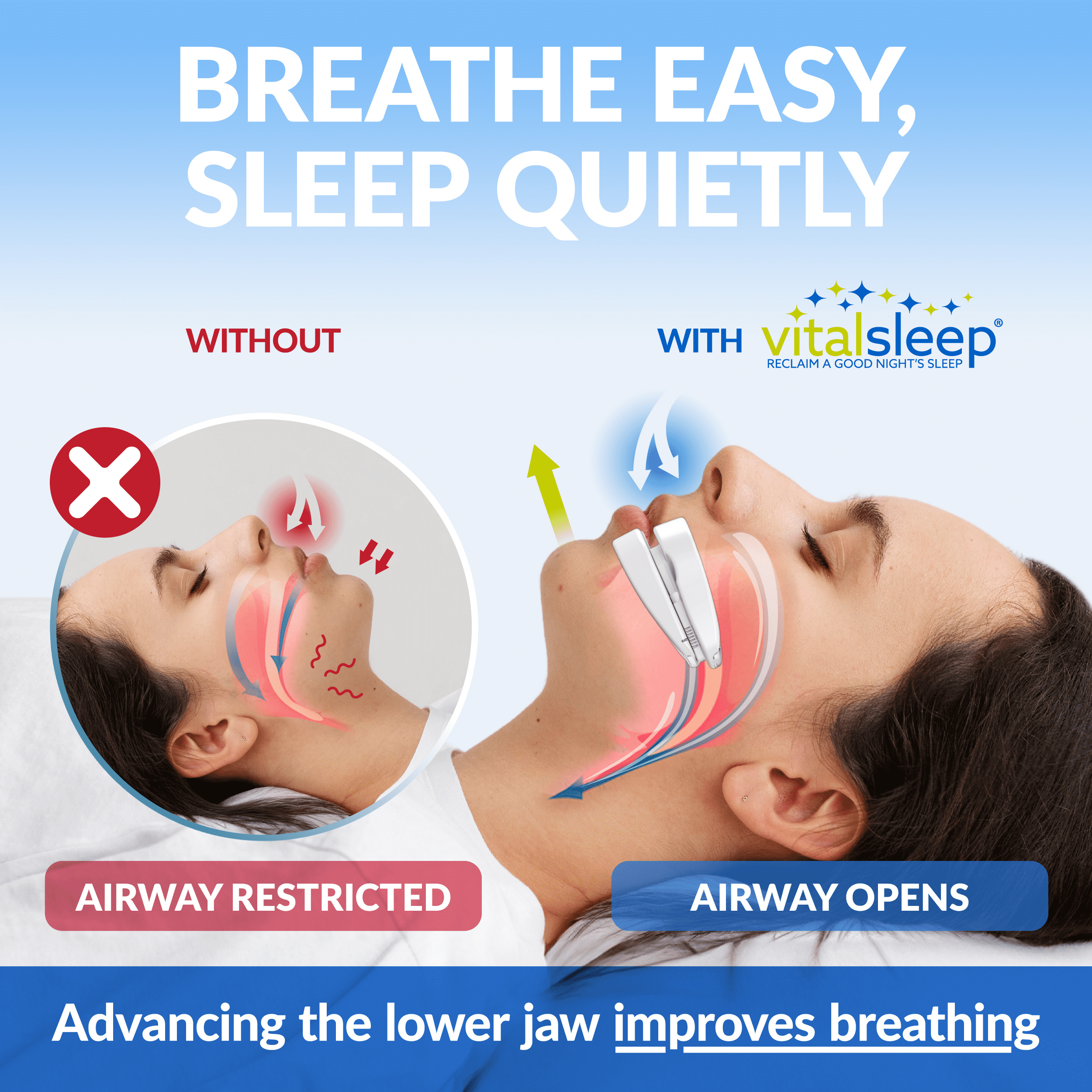 VitalSleep Anti-Snoring Mouthpiece, Comfortable & Adjustable Fit, USA Made, BPA-Free Dental Guard for Restful Sleep, Clear Women's Size